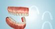 Orthodontic Treatments Without Using Braces